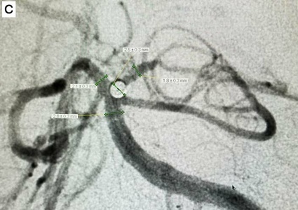 Angiography 3