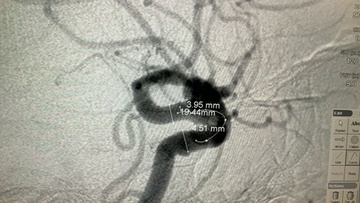 Imaging1