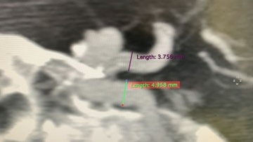 Imaging3