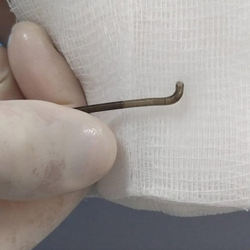 ADAPT with Snake bite technique