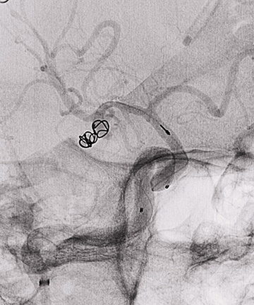 Fig 5