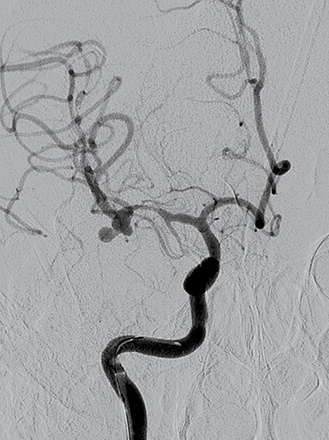 Fig6