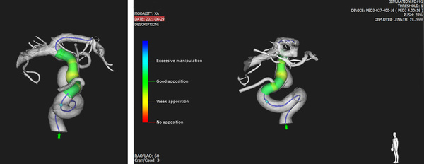 Sim&Size simulation 