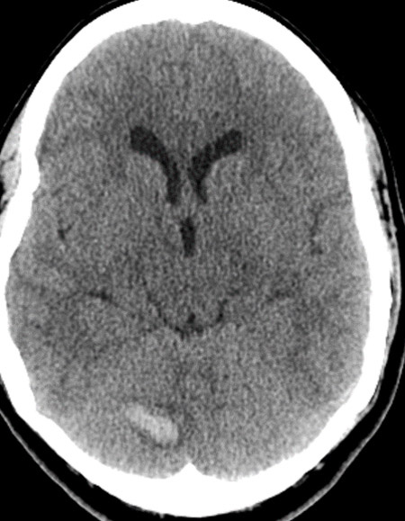 Clinical Presentation