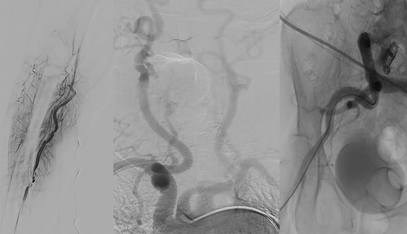 Proximal Access