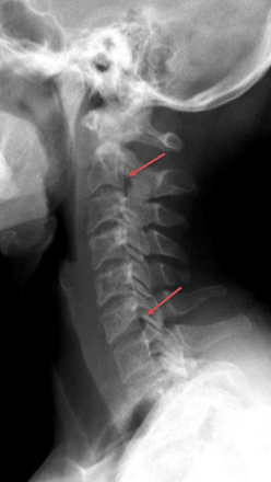 Plain radiograph