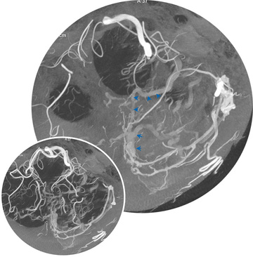 Cone-Beam CT