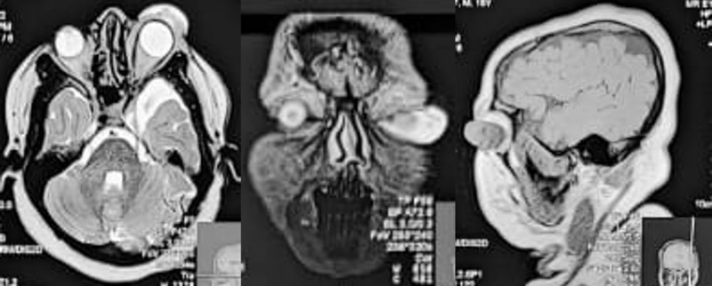 Diagnostic MRI