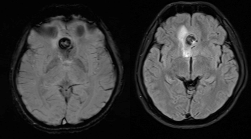Diagnostic MRI