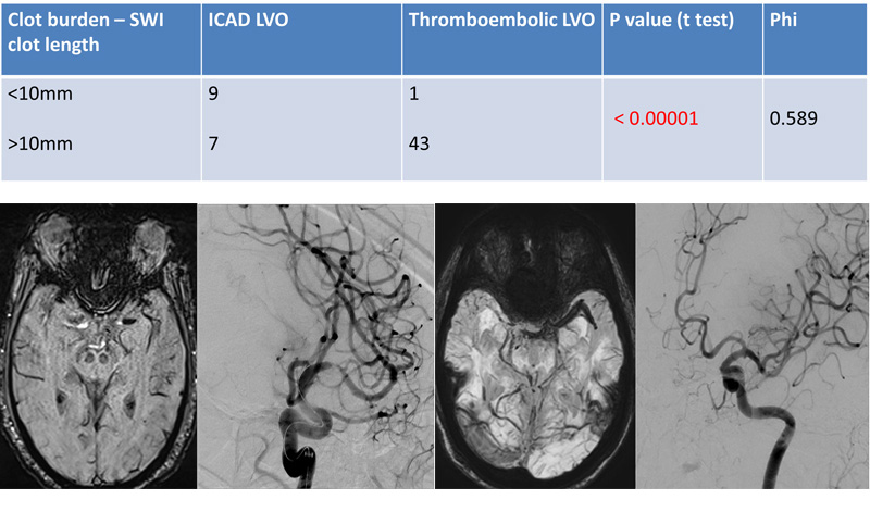 Results – Cut off clot length