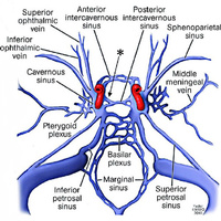 Transvenous access into the CS