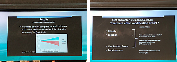 contribution of the CT and CTA to clot imaging