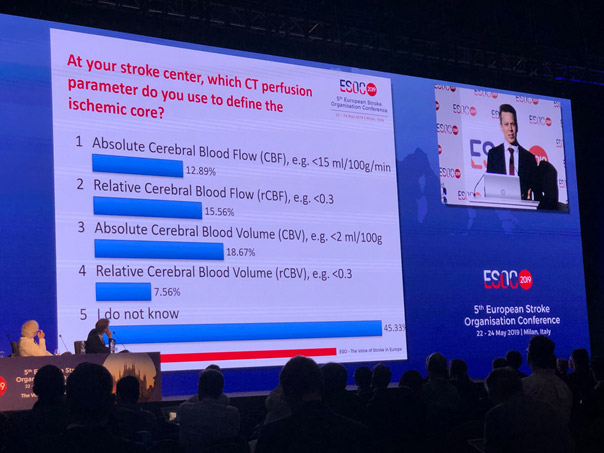 Perfusion parameters