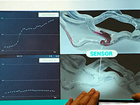 the sensors, being placed in such a way as to cover 360°, might be possible to analyze not only the thrombus itself but also the vessel wall.