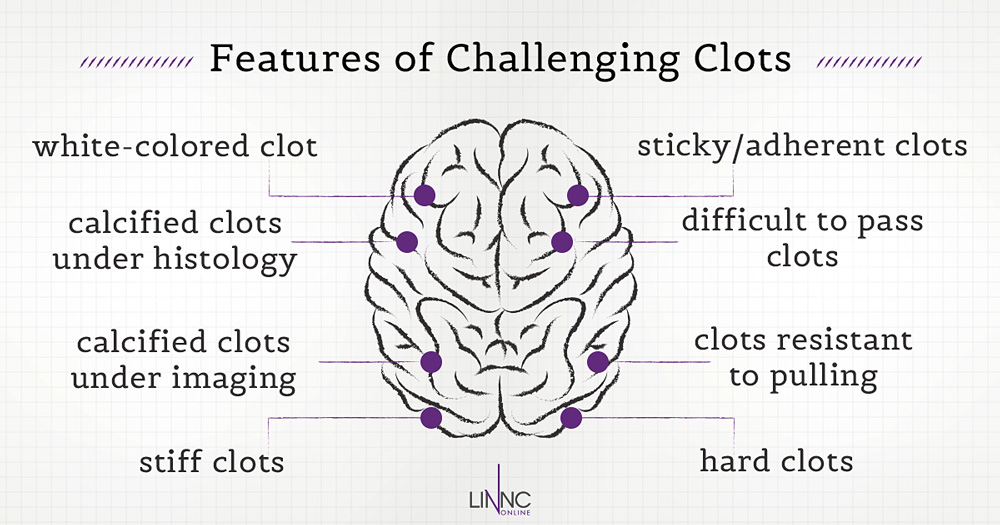 Features of challenging clots