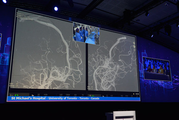 LINNC Paris 2023 - Live case from Toronto