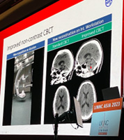 management of a growing basilar aneurysm