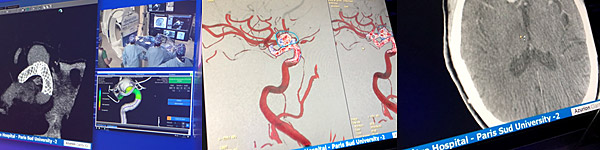 advanced imaging in the angiosuite
