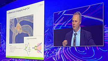 Dr Ray McCarthy perfectly illustrated the difficulties of removing a tough clot which depends on their compositio