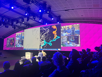 Prof. Laurent Spelle deal with an anterior fossa dural fistula treatment