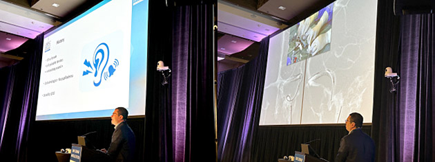 Prof. Vitor Mendes Pereira presented his experience in venous related pulsatile tinnitus management