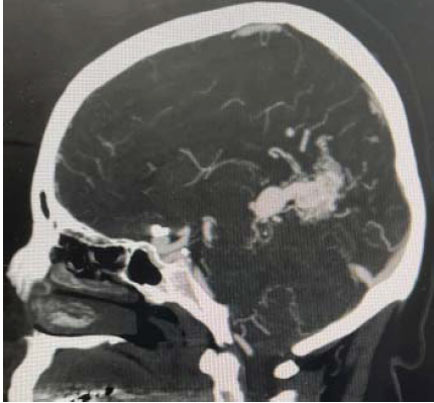 1-the-order-of-the-factors-does-alter-the-result-ct-angiography-1