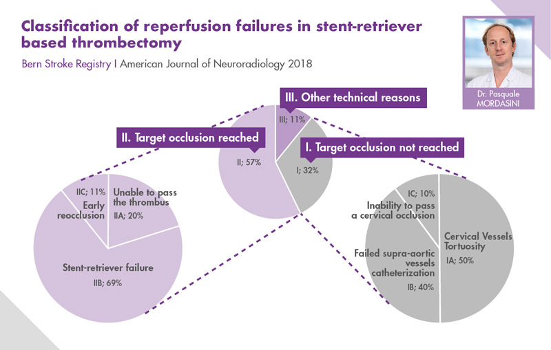 Classification of reperfusion failures in stent-retriever based thrombectomy